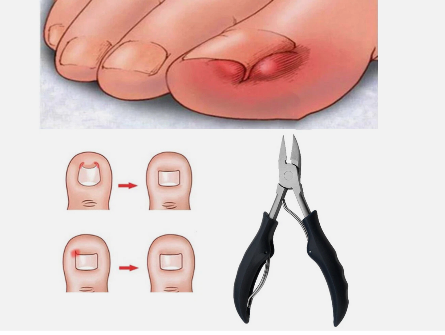 PrecisionGrip™: Professionele Nagelverzorgingsset